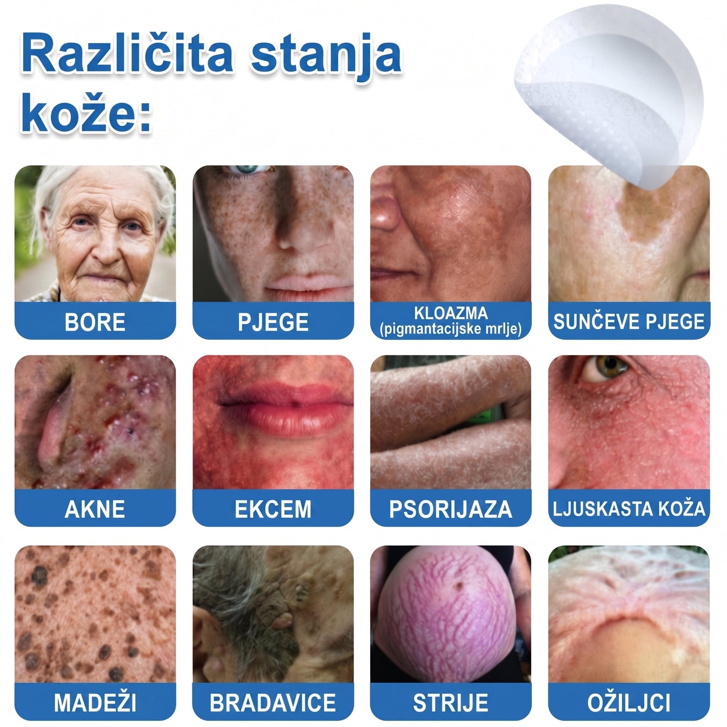 👩‍⚕️ Glimmerly® 2 u 1 MIKROIGLA BESPRIJEKORNA KOŽA | Sredstvo za uklanjanje podignutih madeža, akni, ravnih bradavica i kožnih izraslina | Poboljšava bore, ožiljke i mrlje | Nevidljivi flasteri za prištiće za lice i tijelo | 144 komada