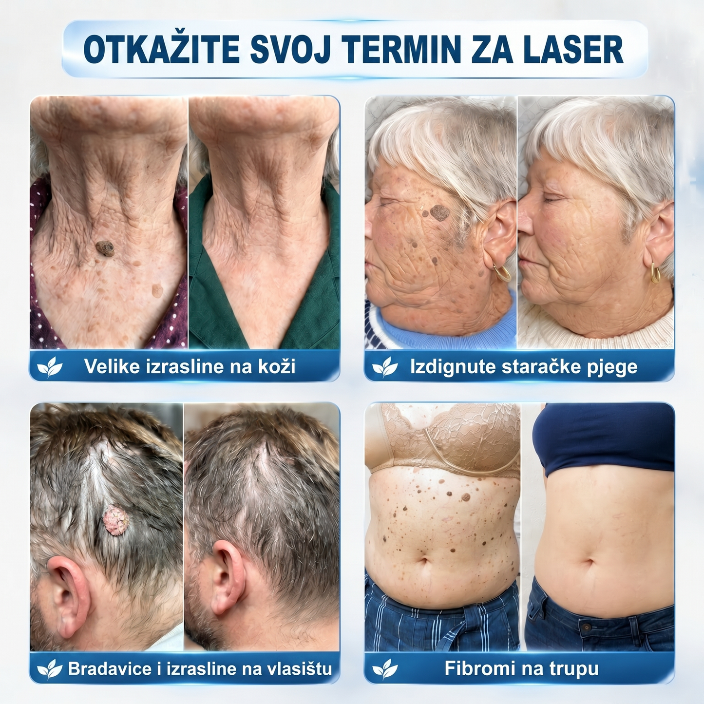 🍀🍀𝐏i𝐜𝐝o® 𝟕-𝐝𝐧𝐞𝐯𝐧𝐢 𝐨𝐝𝐬𝐭𝐫𝐚𝐧𝐣𝐢𝐯𝐚č 𝐛𝐫𝐚𝐝𝐚𝐯𝐢𝐜𝐚 𝐢 𝐦𝐫𝐥𝐢𝐚 (Rollerball bez boli, bez ožiljaka)