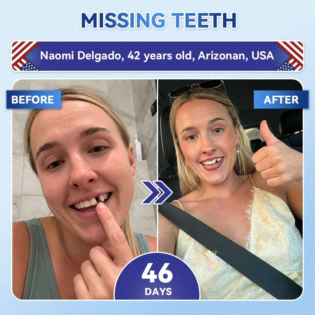 🦷𝐆𝐥𝐢𝐦𝐦𝐞𝐫𝐥𝐲® 🌲Tideglusib flaster s mikroiglama za popravak zubi i desni|Napredne trakice za aktivaciju matičnih stanica (obnavljaju caklinu i dentin, jačaju desni, uklanjaju kamenac i neugodne mirise, zaustavljaju osjetljivost zuba) 3.0