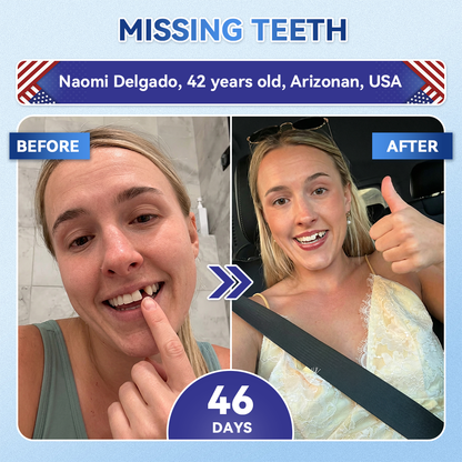 🦷𝐆𝐥𝐢𝐦𝐦𝐞𝐫𝐥𝐲® 🌲Tideglusib flaster s mikroiglama za popravak zubi i desni|Napredne trakice za aktivaciju matičnih stanica (obnavljaju caklinu i dentin, jačaju desni, uklanjaju kamenac i neugodne mirise, zaustavljaju osjetljivost zuba) 3.0