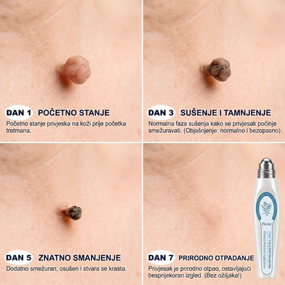 🍀🍀𝐏i𝐜𝐝o® 𝟕-𝐝𝐧𝐞𝐯𝐧𝐢 𝐨𝐝𝐬𝐭𝐫𝐚𝐧𝐣𝐢𝐯𝐚č 𝐛𝐫𝐚𝐝𝐚𝐯𝐢𝐜𝐚 𝐢 𝐦𝐫𝐥𝐢𝐚 (Rollerball bez boli, bez ožiljaka)
